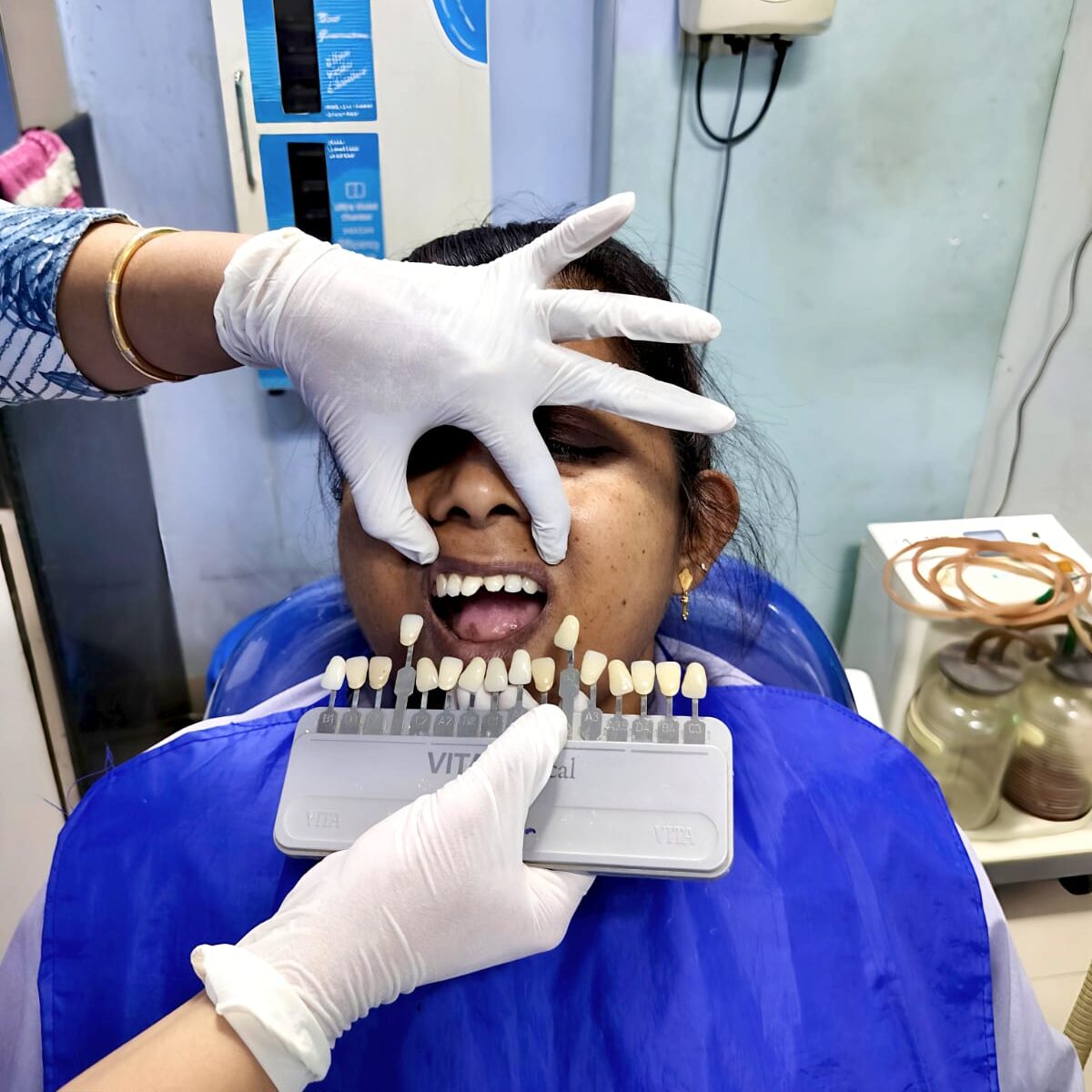dental implants at asha clinic akola 
